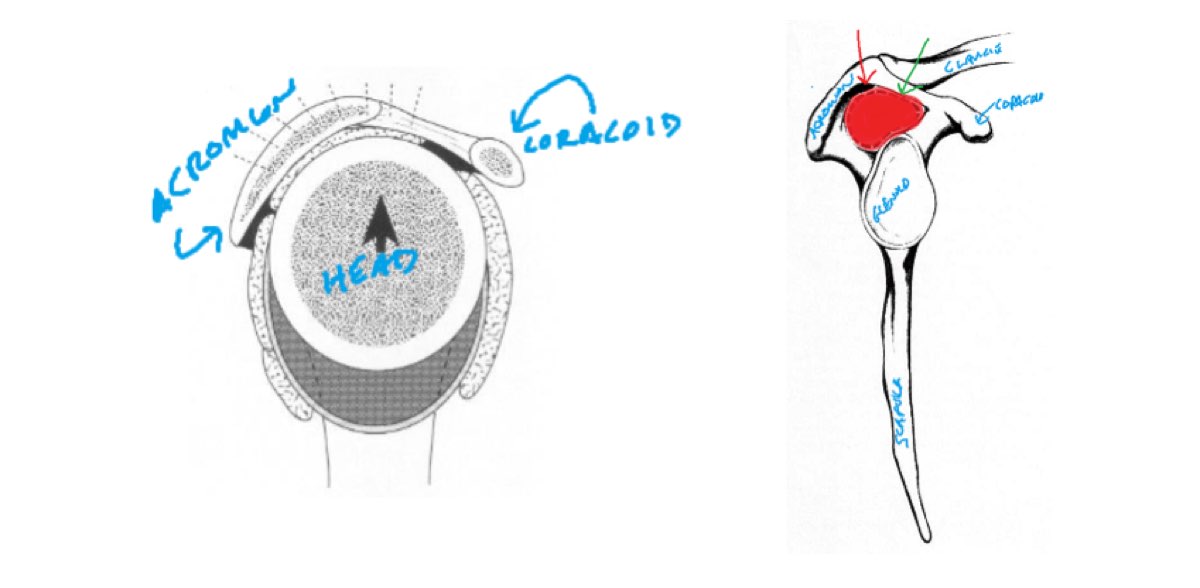 Shoulder-impingement