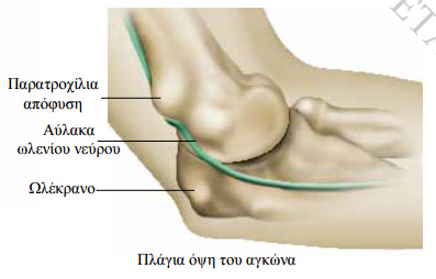agkonas2