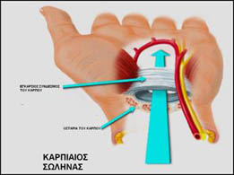 carpal5