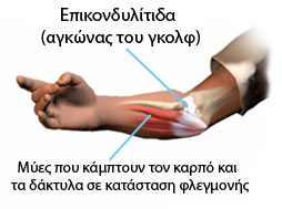 elbow golf01
