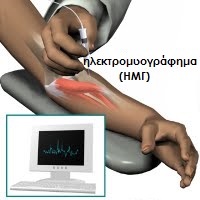 emg