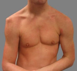exarthrosh-250x229