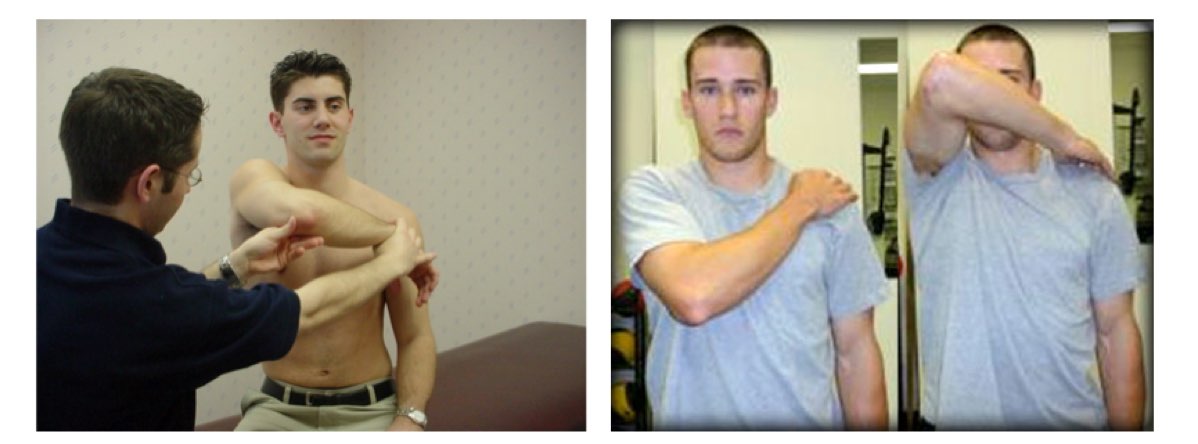 how-to-assess-shoulder-impingement