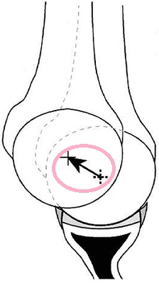 shoulder1