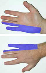ulnar