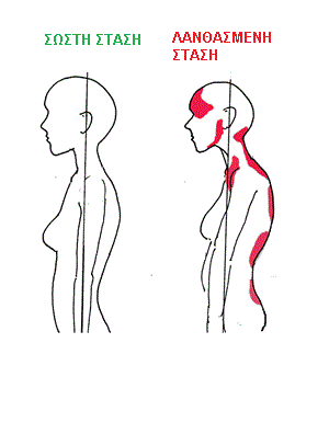 Posture