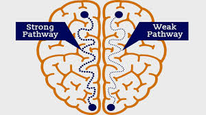 neuroplasticity1