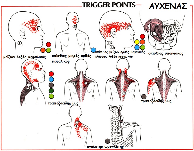 neck-pain-2gr
