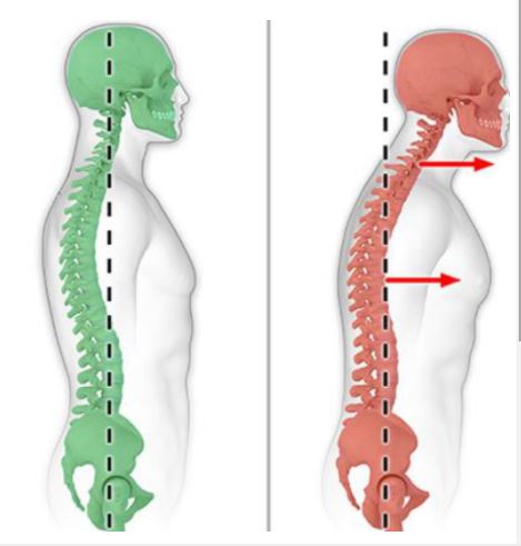 posture