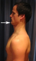 chin tuck