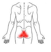 Coccydynia2
