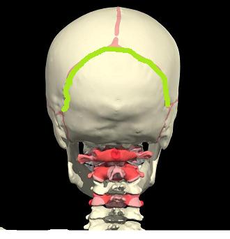 lambdoidsuture