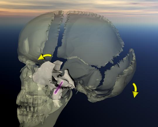 sphenoid