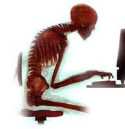 Poor-Posture