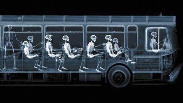 xray 14