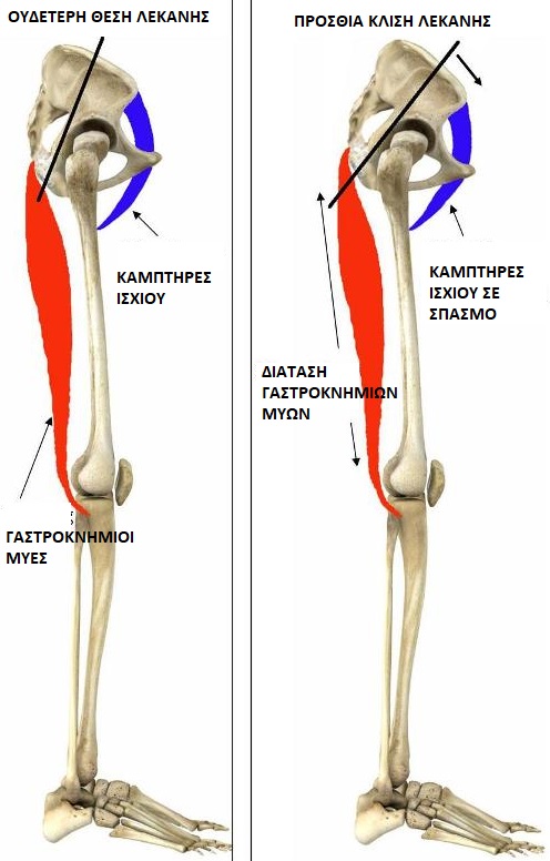 Rotated-Pelvis