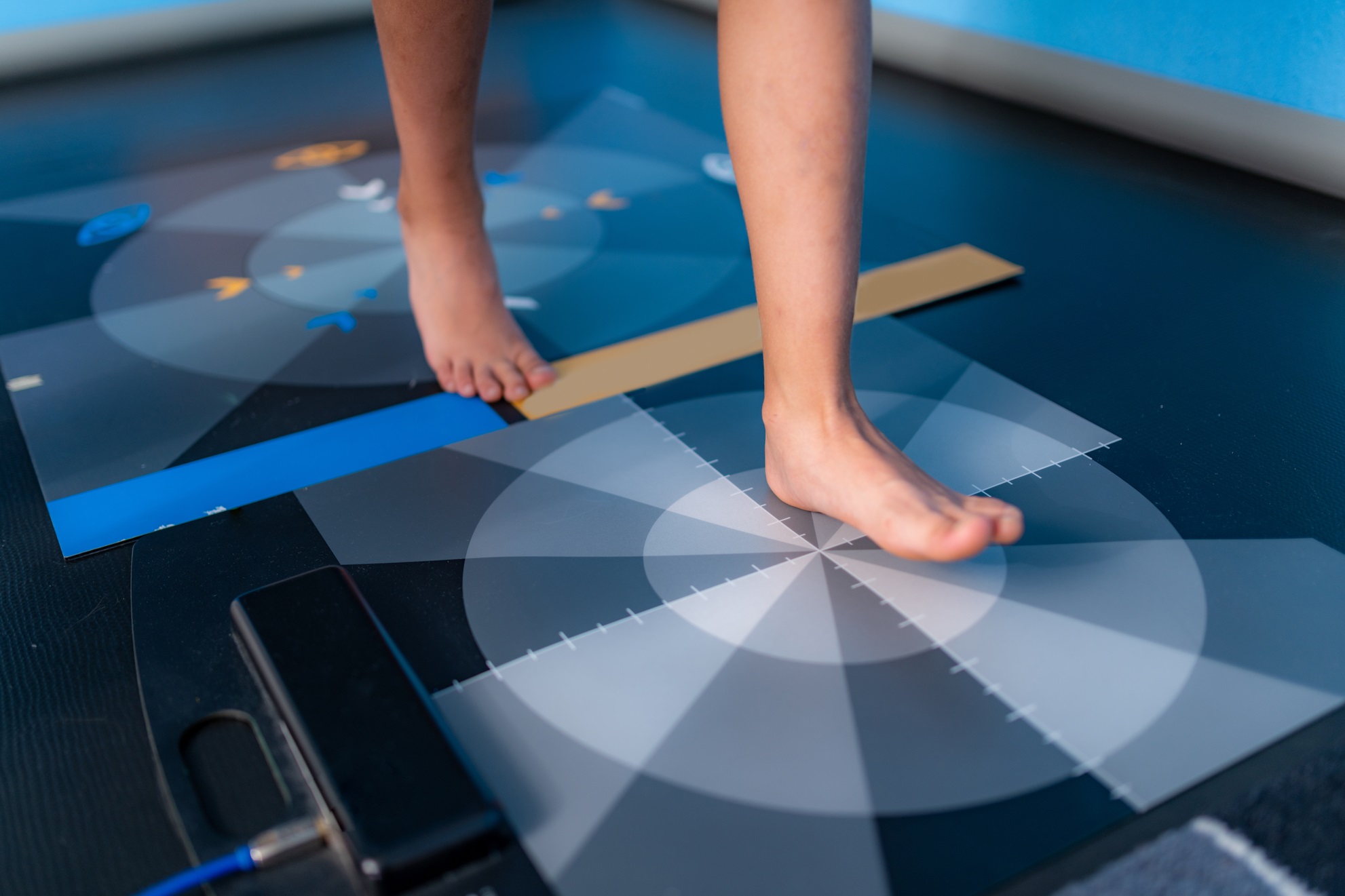baropodometry gait analysis using a foot plate