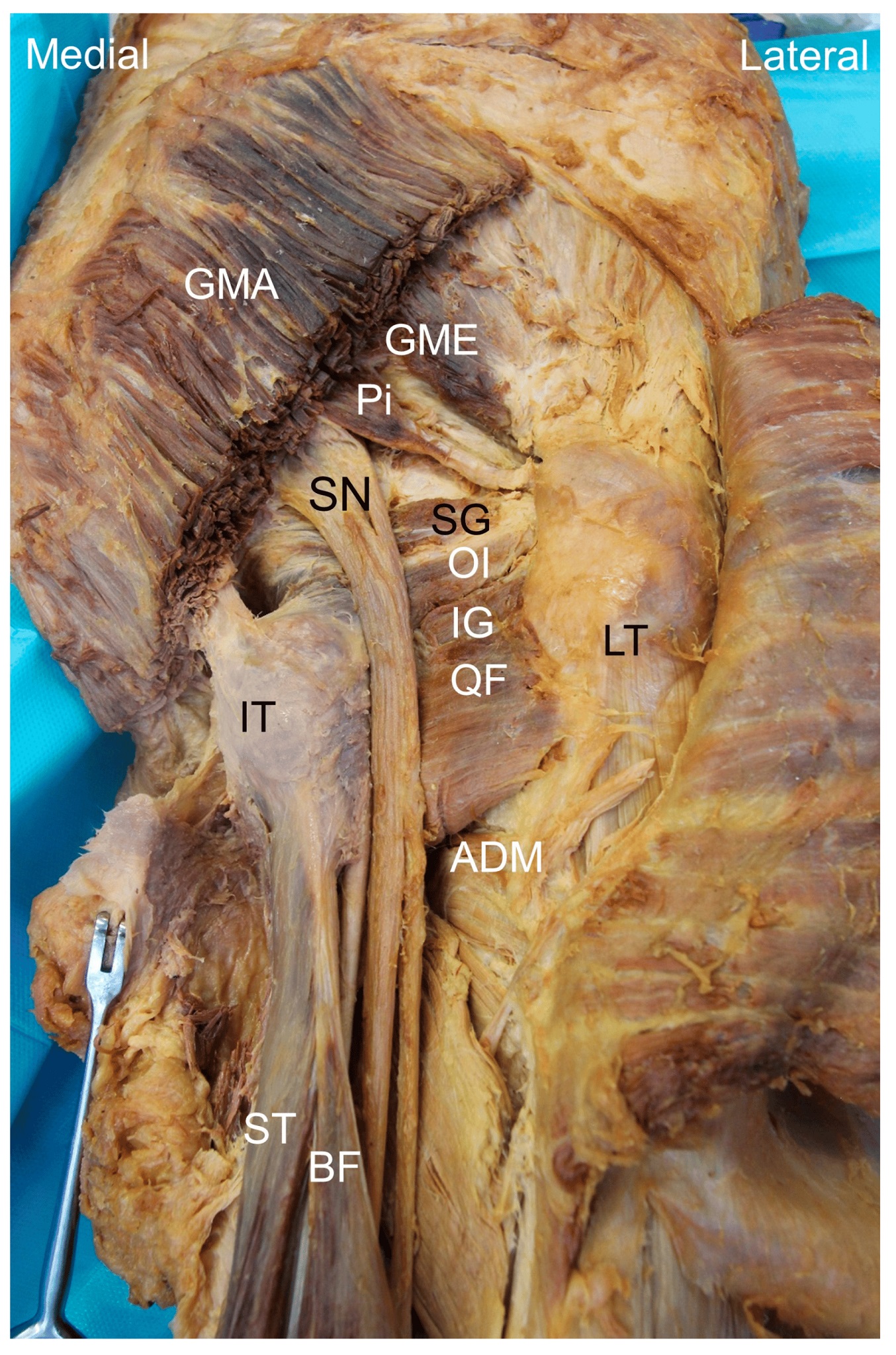 sciatic