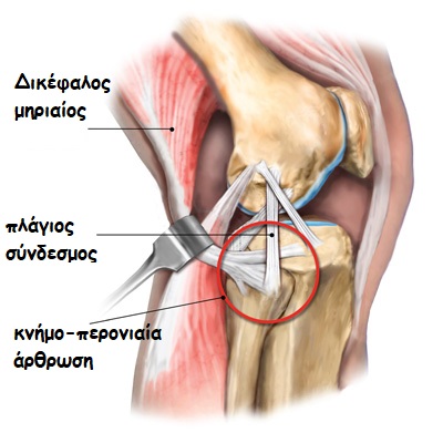 Image1 Tib Fib