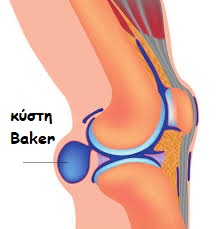 baker