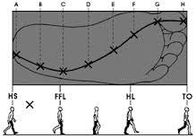 gaitcurve