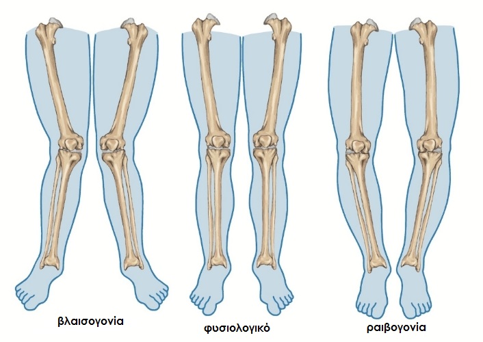 kneepain1