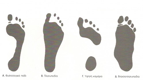 pelma-497x280