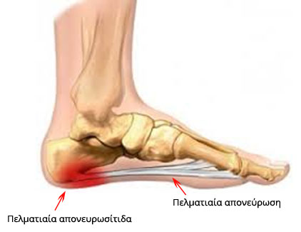 plantar1
