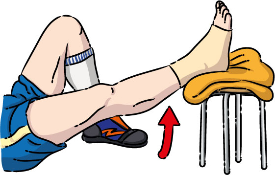 sprain3