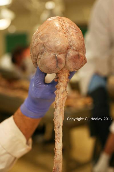 meninges2