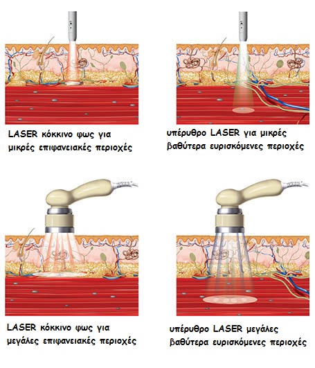 Laser-medical-background2