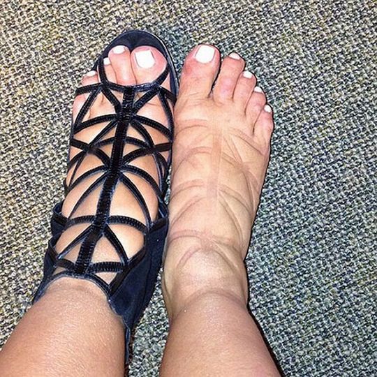 feet