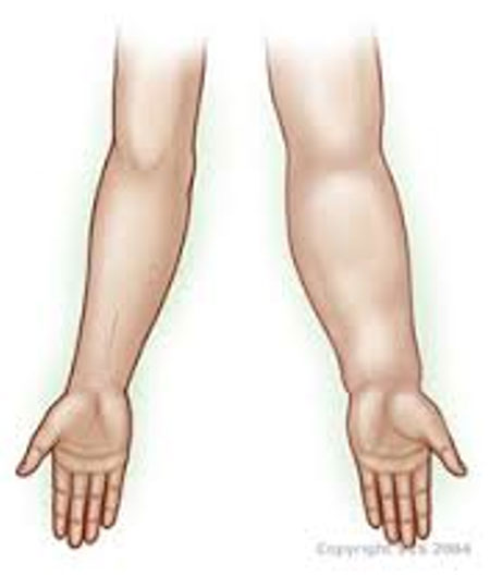 lemfidima deuterogenes 01