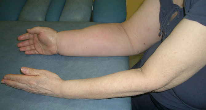 lemfidima deuterogenes therapia 06