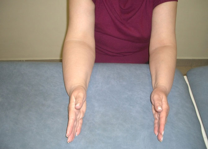 lemfidima deuterogenes therapia 07