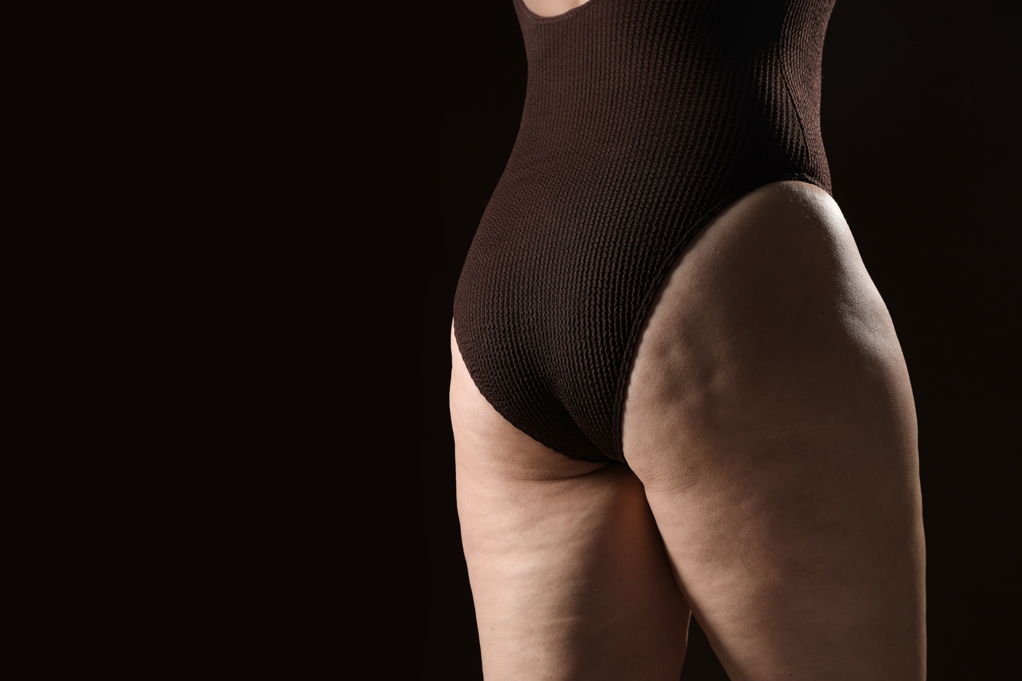 woman with cellulite problem on black background