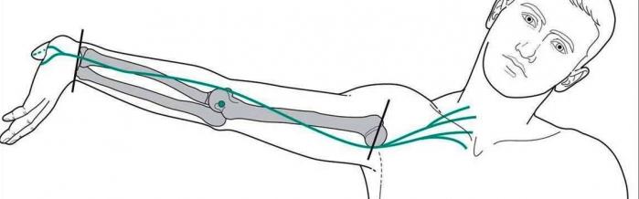 neural tension