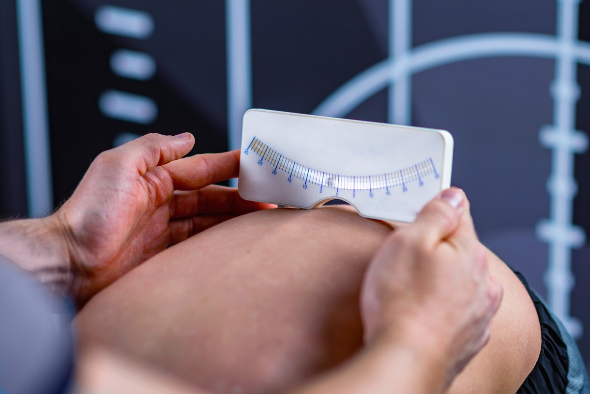 pedi scoliometer for scoliosis screening
