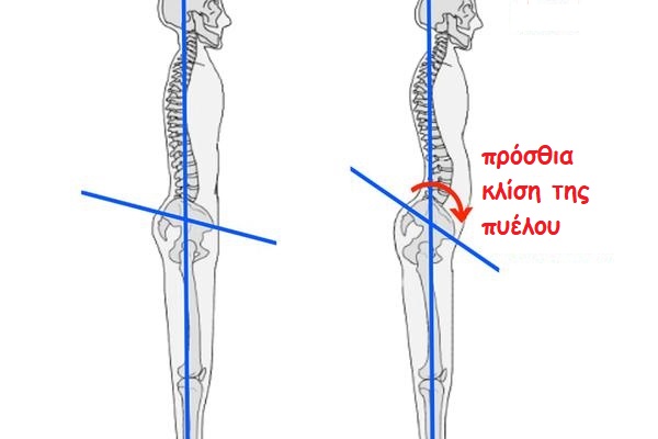 pelvic tilt