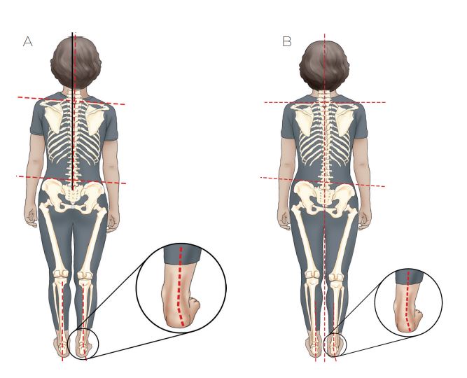 pelvis1