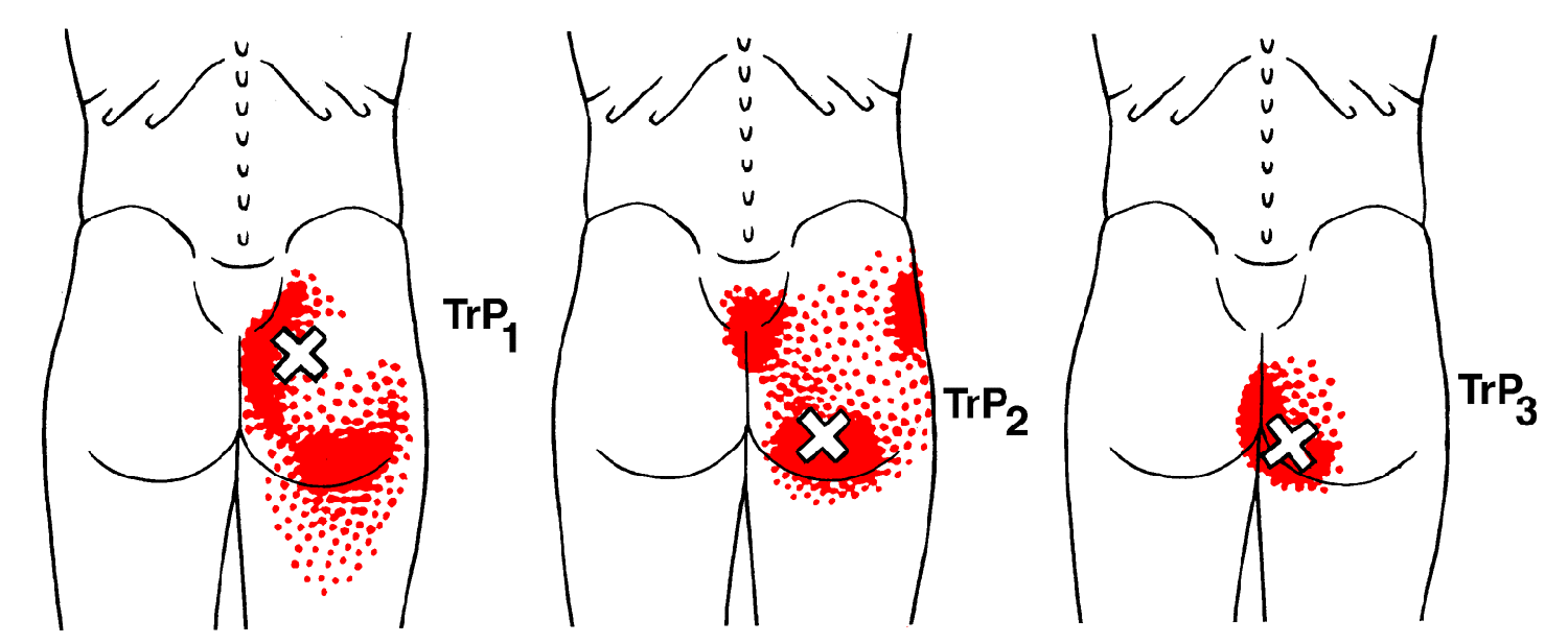 Gluteus Maximus