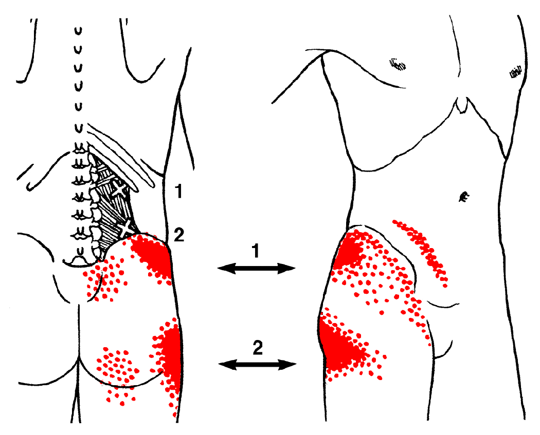 QL trigger points