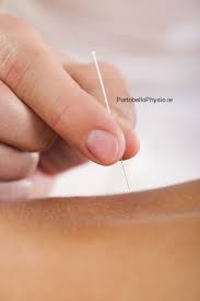 dryneedling