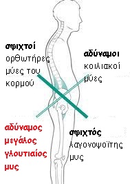 lower-cross-syndrome
