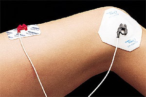 Iontophoresis