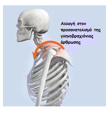 wingedscapula