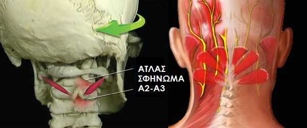 AtlasWedge rightRotation