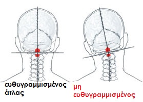 atlassublux1