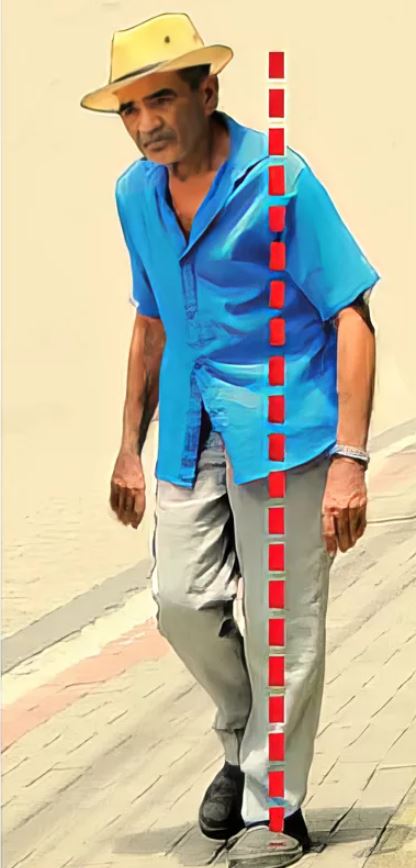 homolateral gait