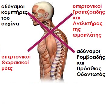 uppercrossedsyndrome.gr